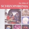 An Atlas of Schizophrenia - Encyclopedia of Visual Medicine Series - Martin Stefan