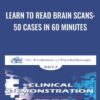 Learn to Read Brain Scans: 50 cases in 60 Minutes - Daniel Amen