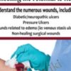 Wound Care: Unlocking the Potential to Heal - Joan Junkin