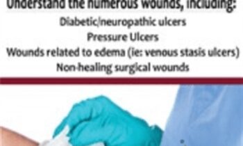 Wound Care: Unlocking the Potential to Heal - Joan Junkin