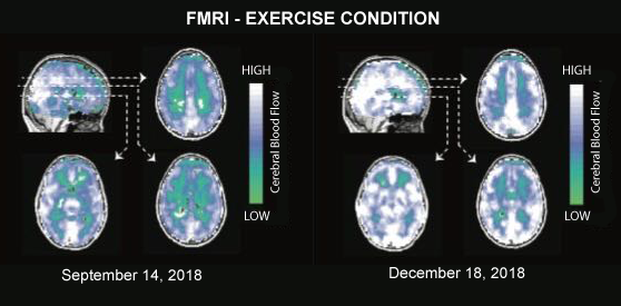 exercise before and after - eSys[GroupBuy]